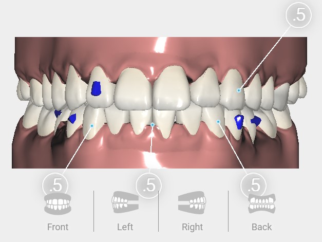 Treatment Plan End Result